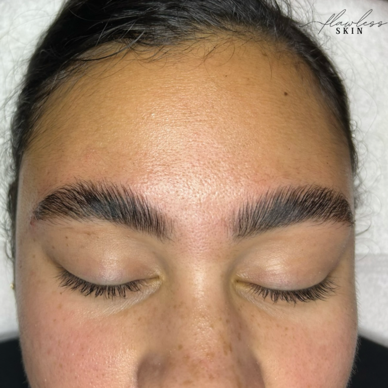 Brow Lamination