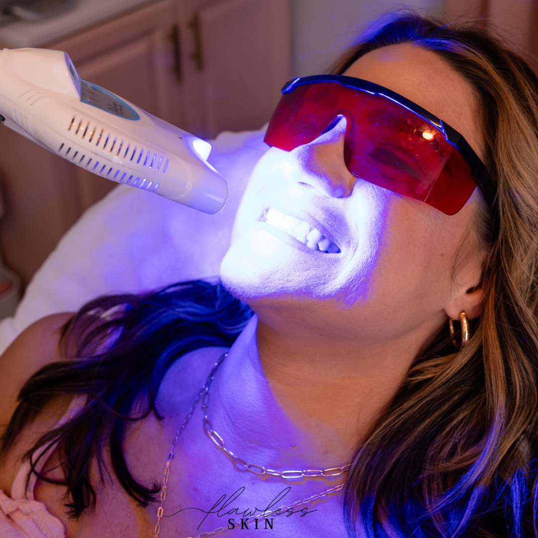 Client receiving a teeth whitening treatment