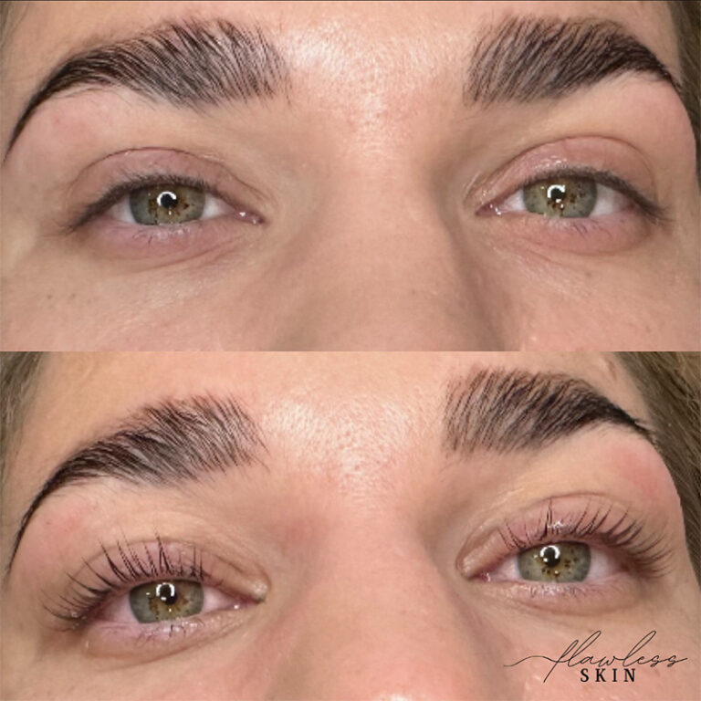 brow lamination and lash lift